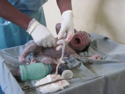 nursing medical intership Kenya: helping deliver a baby.
